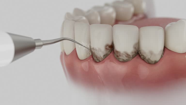 Trusted Dental Implants service in Lathrop, MO - Dentist Open Now